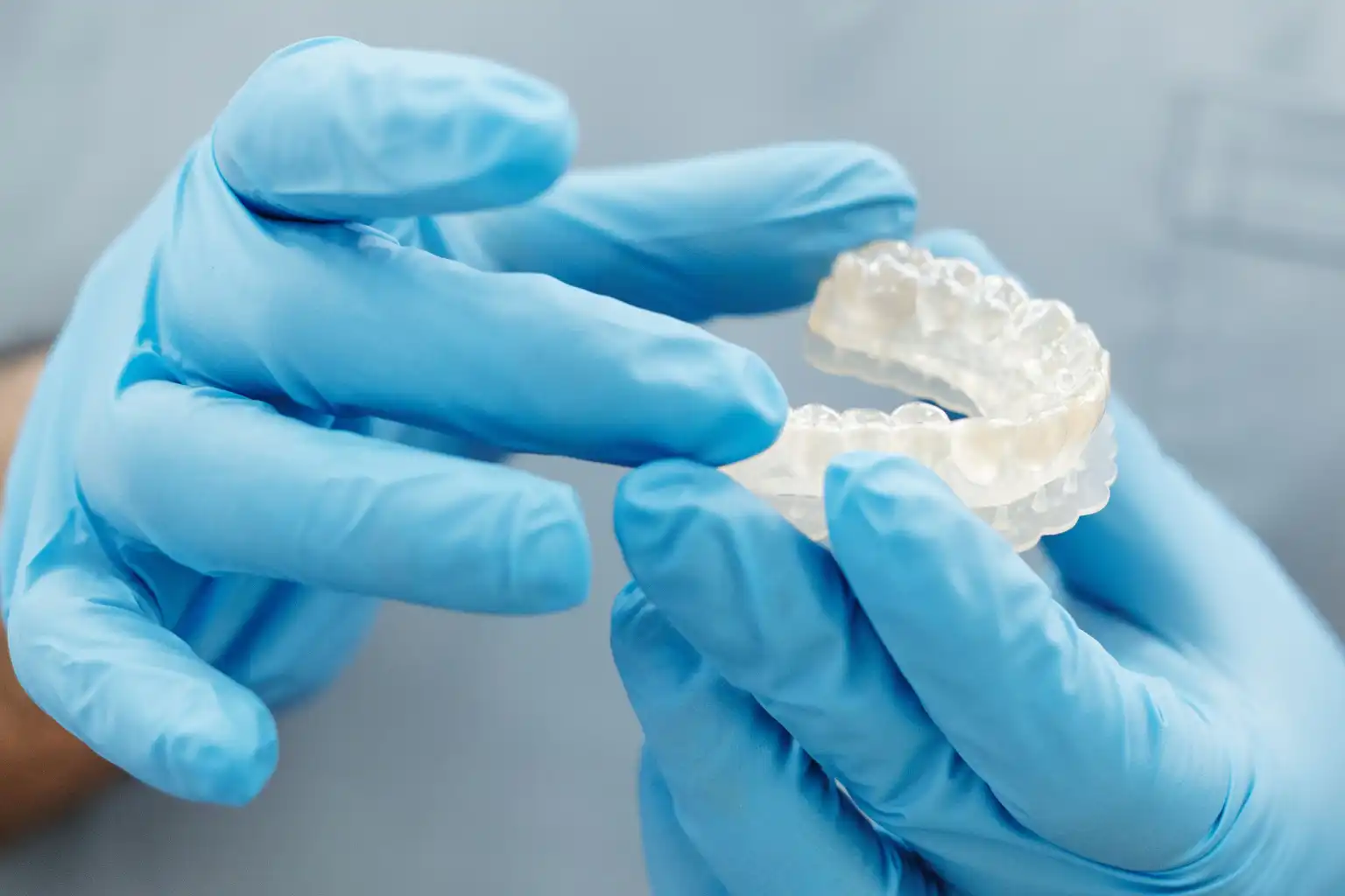 A custom clear night guard on a model of the upper teeth