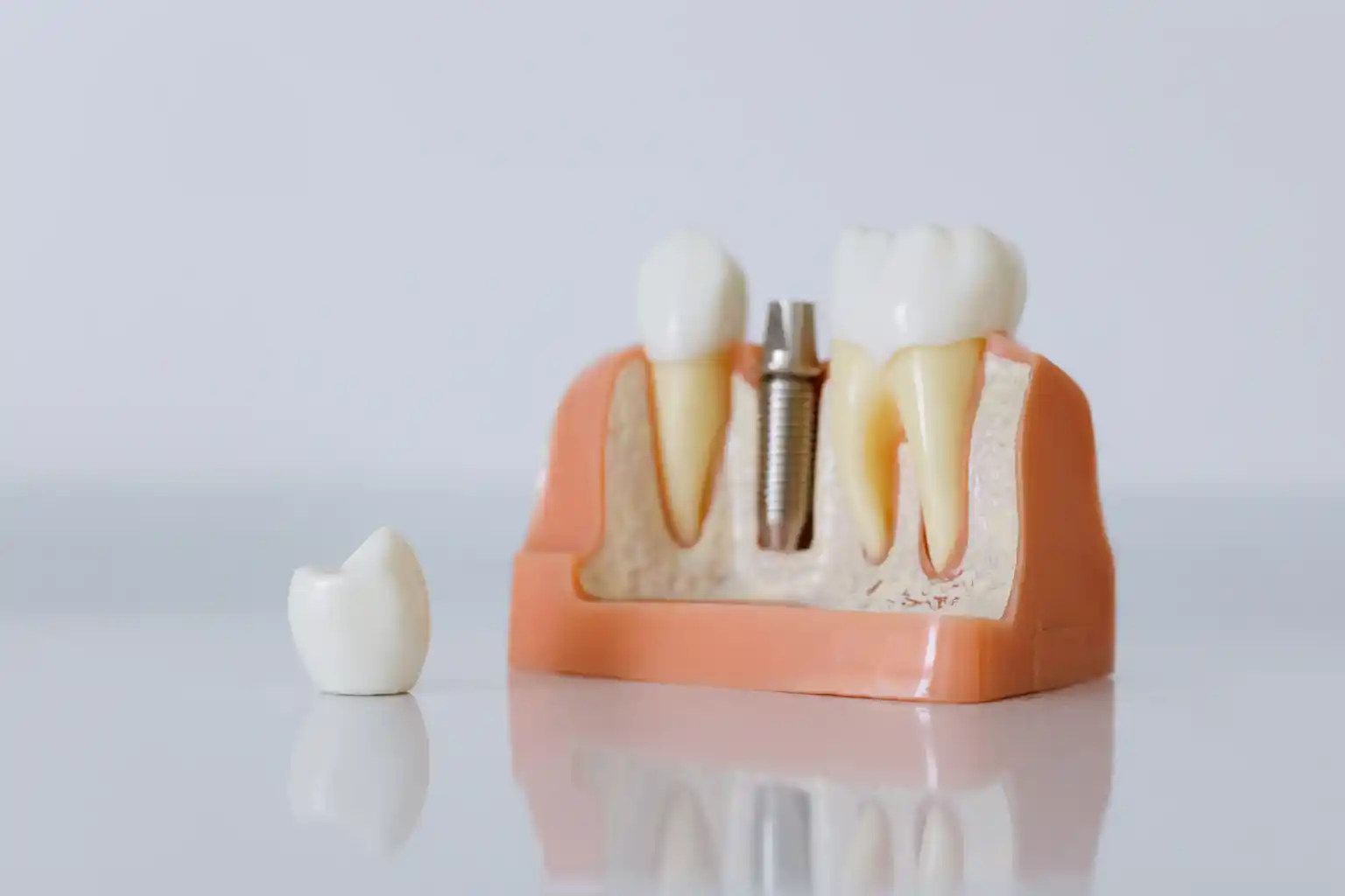 A dentist explaining a dental implant model to a patient